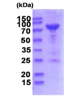 SDS-PAGE - Recombinant Human PNPT1 protein (AB202628), expandable thumbnail