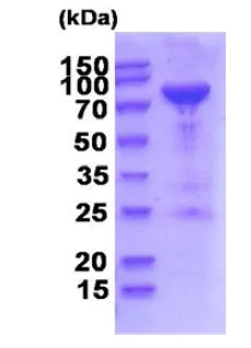 SDS-PAGE - Recombinant Human PNPT1 protein (His tag N-Terminus) (AB202628)