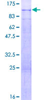 Recombinant Human PODN protein