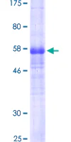 SDS-PAGE - Recombinant Human Podoplanin protein (GST tag N-Terminus) (AB132033)