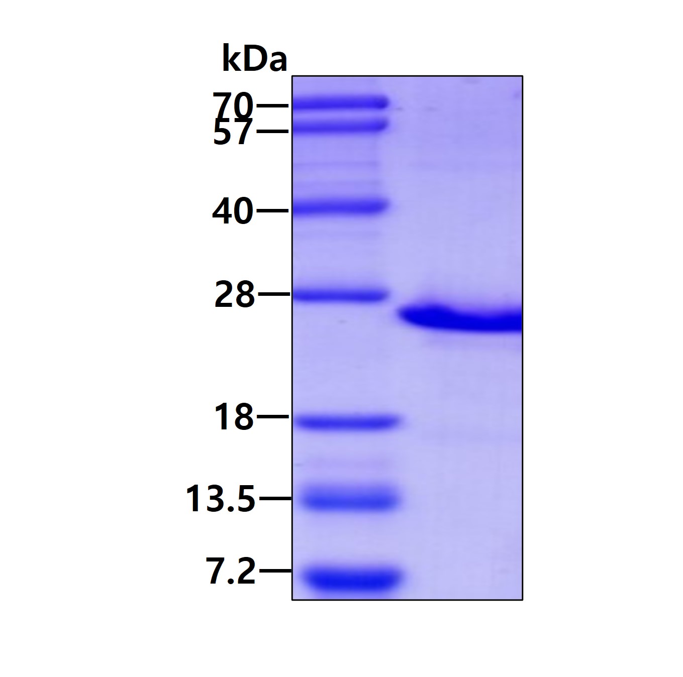 SDS-PAGE - Recombinant Human Podoplanin protein (His tag N-Terminus) (AB87357)