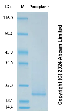 SDS-PAGE - Recombinant Human Podoplanin Protein Standard (His tag) (AB323054)