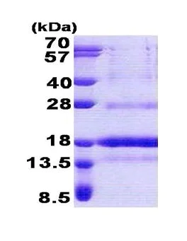 SDS-PAGE - Recombinant Human POLD4 protein (AB171583)
