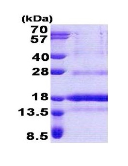 SDS-PAGE - Recombinant Human POLD4 protein (His tag N-Terminus) (AB171583)
