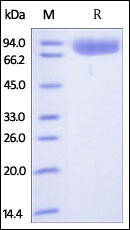 SDS-PAGE - Recombinant human Polymeric immunoglobulin receptor/PIGR protein (Active) (AB174011), expandable thumbnail