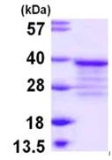 SDS-PAGE - Recombinant Human POMC protein (AB108118)