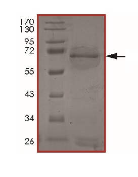 SDS-PAGE - Recombinant Human POMK protein (AB201392)