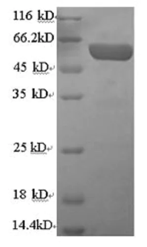 SDS-PAGE - Recombinant Human PON1 protein (Tagged) (AB235863)