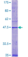 SDS-PAGE - Recombinant Human POP5 protein (GST tag N-Terminus) (AB162526)
