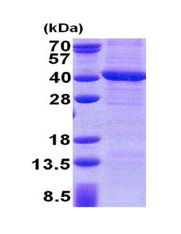SDS-PAGE - Recombinant Human PP-X protein (denatured) (AB171584), expandable thumbnail