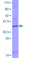 SDS-PAGE - Recombinant Human PP11 protein (AB160260)