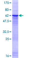 SDS-PAGE - Recombinant Human PP2A-alpha protein (Tagged) (AB114424), expandable thumbnail