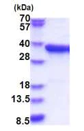 SDS-PAGE - Recombinant Human PPA2 protein (His tag N-Terminus) (AB183243)