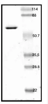SDS-PAGE - Recombinant Human PPAR gamma protein (AB53382)