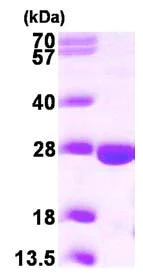 SDS-PAGE - Recombinant Human PPCDC protein (His tag N-Terminus) (AB101184)