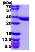 SDS-PAGE - Recombinant Human PPCS protein (His tag N-Terminus) (AB107145)