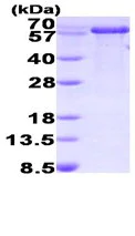 SDS-PAGE - Recombinant human PPIL2 protein (His tag N-Terminus) (AB93731)