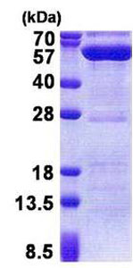 SDS-PAGE - Recombinant Human PPM1F/POPX2 protein (His tag N-Terminus) (AB171704)