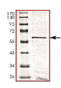 SDS-PAGE - Recombinant human PPP1A/PPP1CA protein (AB128559)