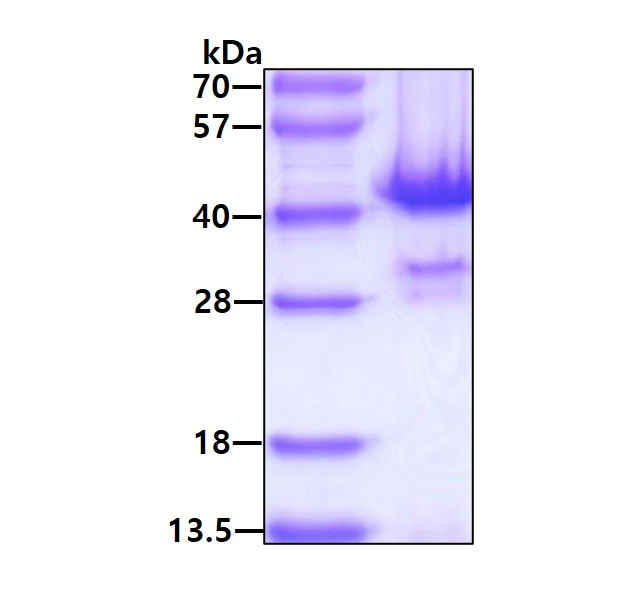 SDS-PAGE - Recombinant human PPP1A/PPP1CA protein (His tag N-Terminus) (AB113150)