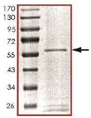 Western blot - Recombinant human PPP1CB (AB128551)