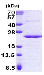 SDS-PAGE - Recombinant Human PPP1R11 protein (AB167857)