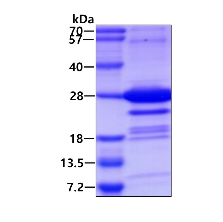 SDS-PAGE - Recombinant Human PPP1R1A protein (AB78756)