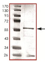 SDS-PAGE - Recombinant Human PPP2CB protein (AB128562)