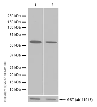 Western blot - Recombinant Human PPP2CB protein (AB128562)
