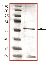 SDS-PAGE - Recombinant Human PPP2CB protein (GST tag N-Terminus) (AB128562)