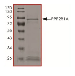 SDS-PAGE - Recombinant Human PPP2R1A protein (Tagged) (AB268881)