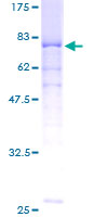 Recombinant Human PPP2R2A protein