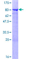SDS-PAGE - Recombinant Human PPP2R5A protein (AB159173)