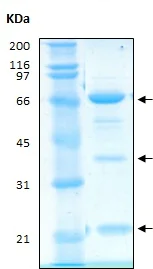 SDS-PAGE - Recombinant Human PPP3CA + PPP3R1 protein (AB186081)
