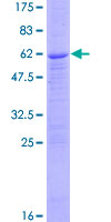 SDS-PAGE - Recombinant Human PPT1/PPT protein (AB116764), expandable thumbnail