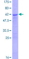 SDS-PAGE - Recombinant Human PPT1/PPT protein (GST tag N-Terminus) (AB116764)