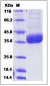 SDS-PAGE - Recombinant Human PPT1/PPT protein (His tag) (AB276628)