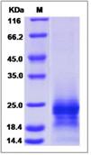 SDS-PAGE - Recombinant Human PRAP1 protein (His tag) (AB276656), expandable thumbnail