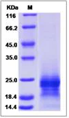 SDS-PAGE - Recombinant Human PRAP1 protein (His tag) (AB276656)