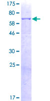 SDS-PAGE - Recombinant Human PRCP protein (AB159182), expandable thumbnail
