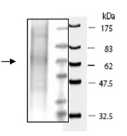 SDS-PAGE - Recombinant Human PRCP protein (His tag) (AB198658), expandable thumbnail