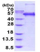 SDS-PAGE - Recombinant Human PRD protein (His tag N-Terminus) (AB202165)
