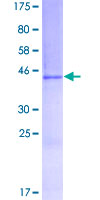 SDS-PAGE - Recombinant Human PRDC protein (AB163828), expandable thumbnail