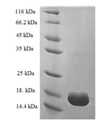 SDS-PAGE - Recombinant Human Prealbumin protein (His tag) (AB237561)