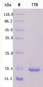 SDS-PAGE - Recombinant Human Prealbumin Protein Standard (His tag) (AB316385), expandable thumbnail