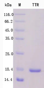 SDS-PAGE - Recombinant Human Prealbumin Protein Standard (His tag) (AB316385)