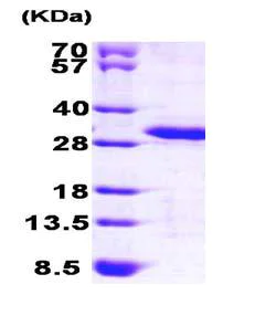 SDS-PAGE - Recombinant Human PREI3 protein (His tag N-Terminus) (AB101639)