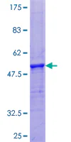 SDS-PAGE - Recombinant Human PRH1 + PRH2 protein (GST tag N-Terminus) (AB159184)