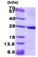 SDS-PAGE - Recombinant Human Prion protein PrP (denatured) (His tag N-Terminus) (AB140567)