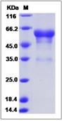 SDS-PAGE - Recombinant Human Prion protein PrP (Fc Chimera) (AB276456), expandable thumbnail